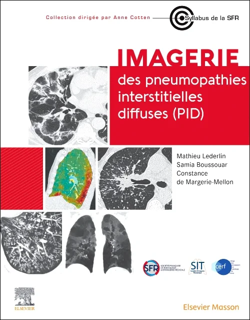 Coperta cărții "Imagerie des pneumopathies interstitielles diffuses (PID)" de autor necunoscut
