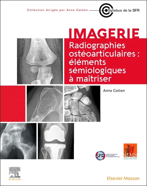 Coperta cărții "Radiographies ostéoarticulaires : éléments sémiologiques à maitriser" de autor necunoscut