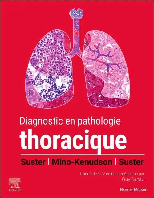 Coperta cărții "Diagnostic en pathologie thoracique" de autor necunoscut