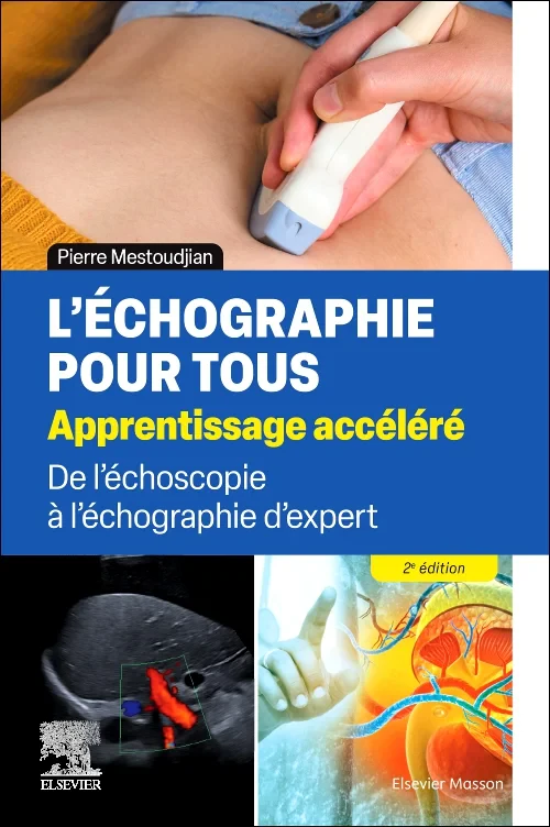 Coperta cărții "L&#039;échographie pour tous : apprentissage accéléré" de autor necunoscut