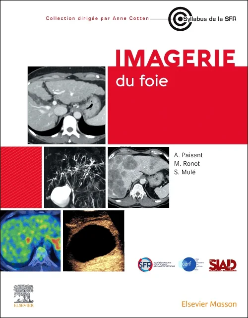 Coperta cărții "Imagerie du foie" de autor necunoscut
