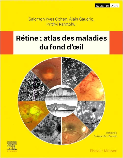 Coperta cărții "Rétine : atlas des maladies du fond d&#039;oeil" de autor necunoscut