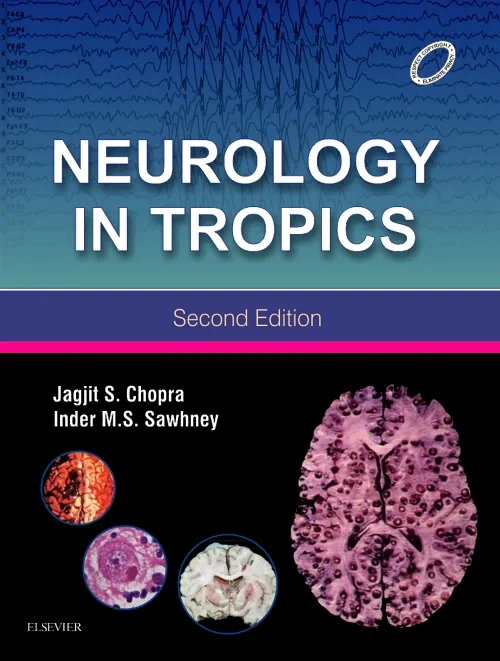 Coperta cărții "Neurology in Tropics" de autor necunoscut