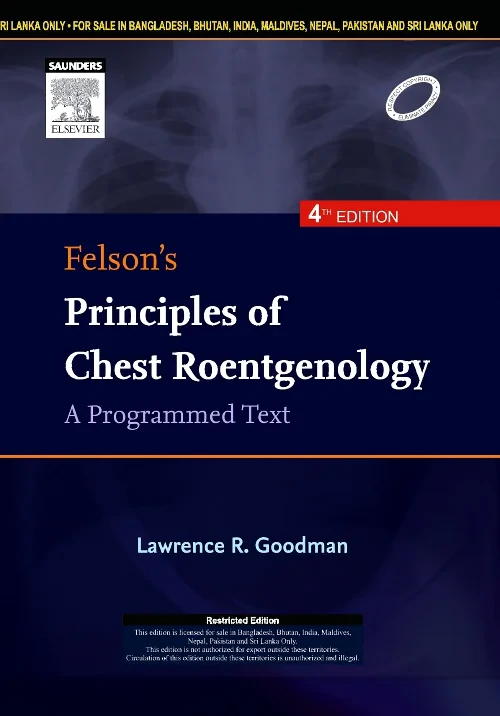 Coperta cărții "Felson&#039;s Principles of Chest Roentgenology, A Programmed Text" de autor necunoscut