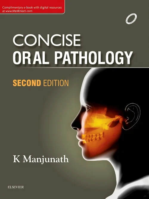 Coperta cărții "Concise Oral Pathology" de autor necunoscut